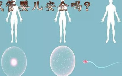 台湾试管婴儿自助攻略分享，流程、费用一清二楚