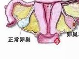 女孩有子宫无卵巢该怎么保养？